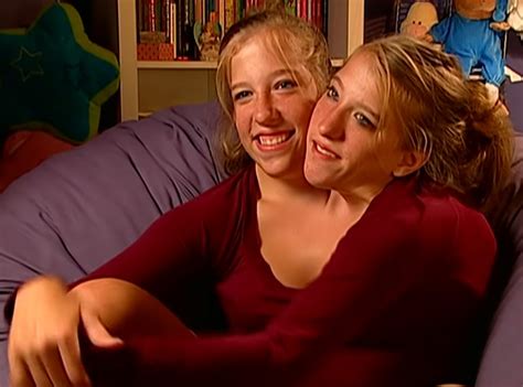 abby and brittany nude|Abby and Brittany Hensel